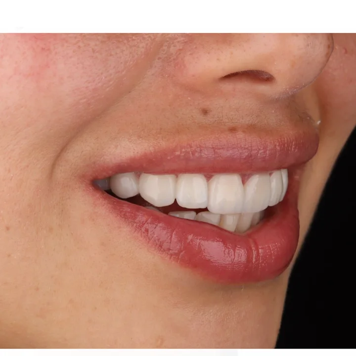 Después: sonrisa renovada